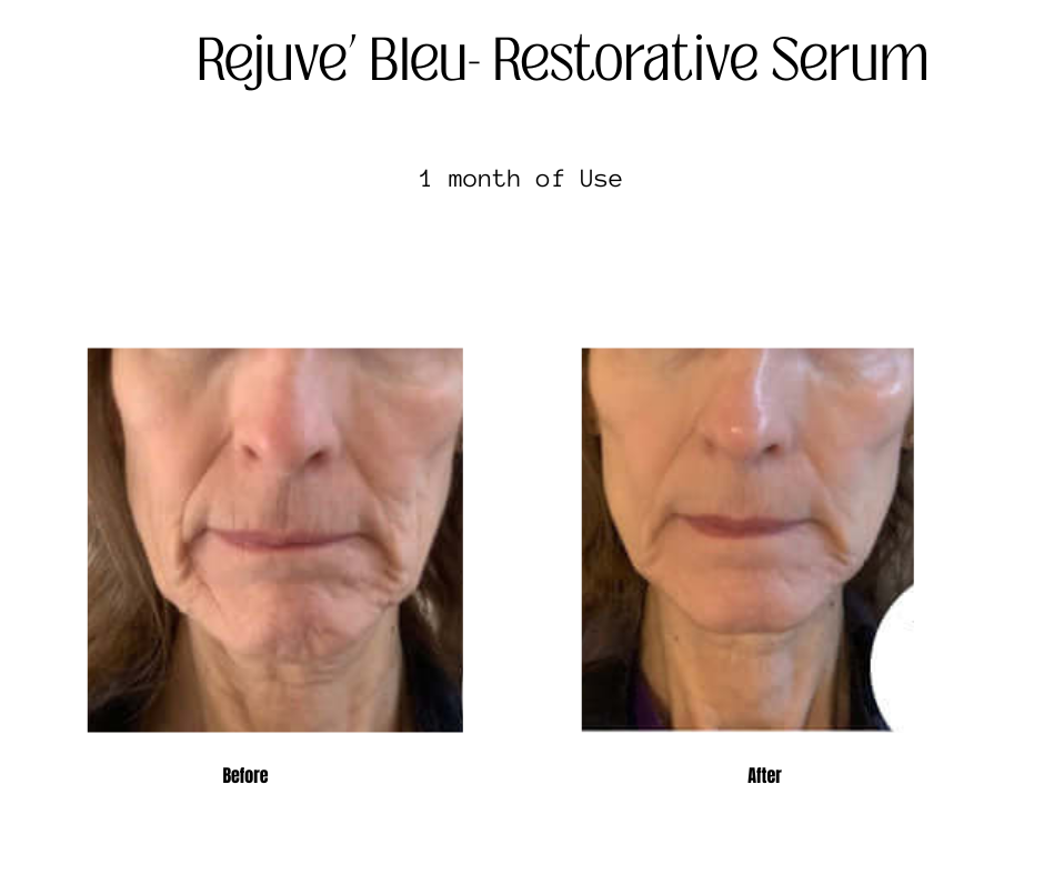 Rejuve' Bleu Serum