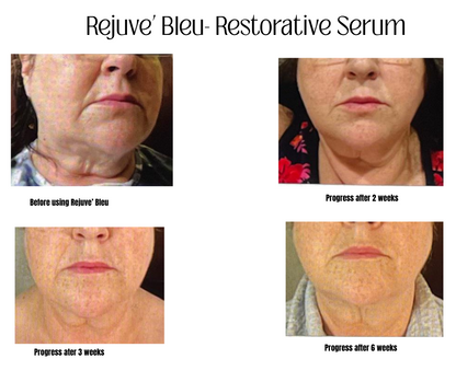 Rejuve' Bleu Serum