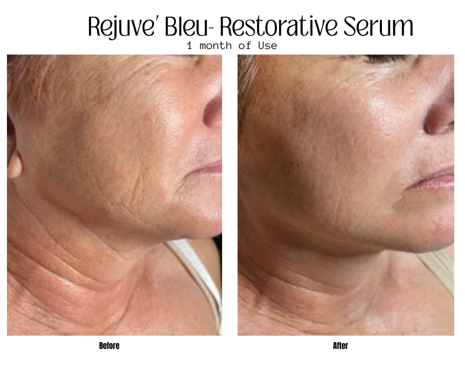 Rejuve' Bleu Serum
