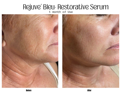 Rejuve' Bleu Serum
