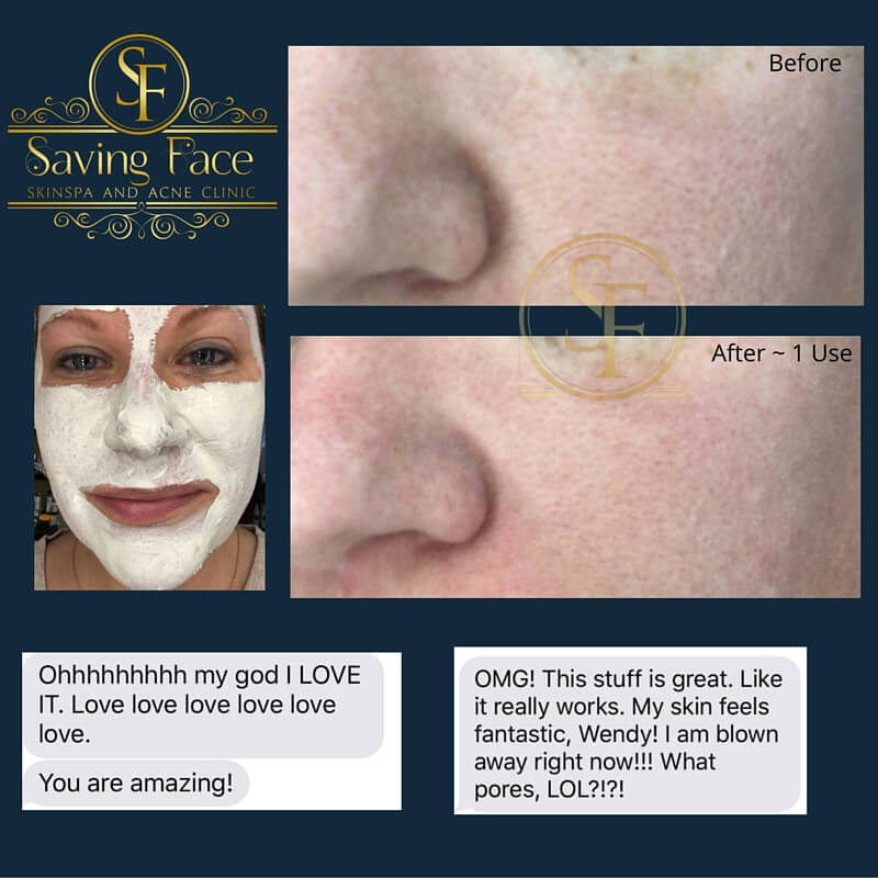 Porefection mask before/after